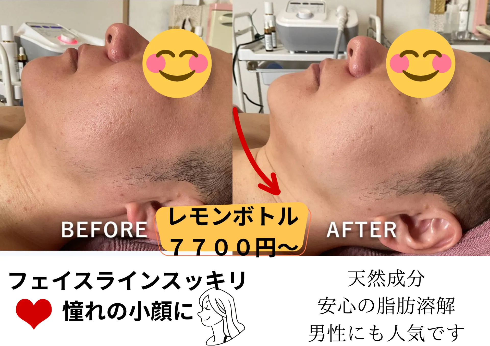 大人気　レモンボトル